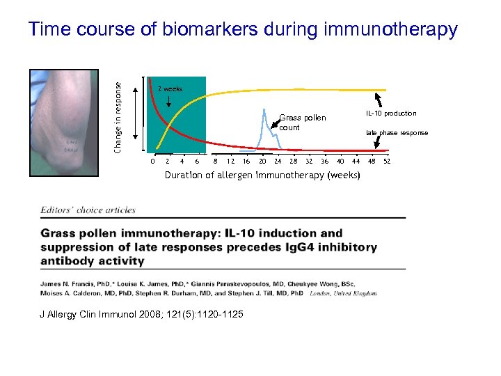 Change in response Time course of biomarkers during immunotherapy 2 weeks IL-10 production Grass