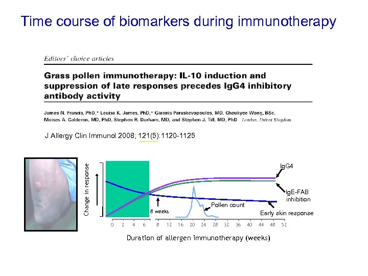 Time of biomarkers during immunotherapy Time course of changes in IL-10 and Ig. G-associated