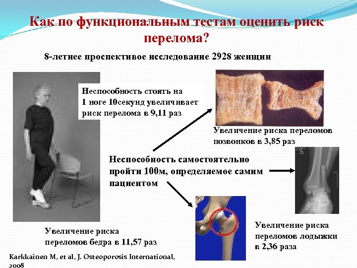 Остеопороз что это за болезнь. Остеопороз риск переломов. Факторы риска переломов. Остеопороз мужчина. Остеопороз это простыми словами.