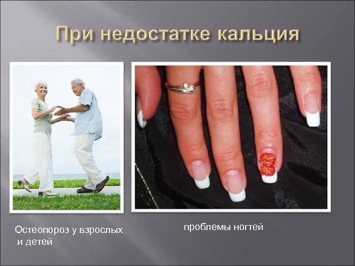 Остеопороз у взрослых и детей проблемы ногтей 