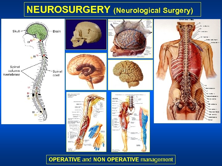 NEUROSURGERY (Neurological Surgery) OPERATIVE and NON OPERATIVE management 