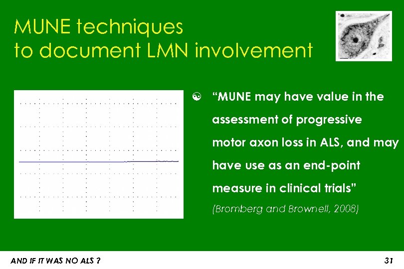 MUNE techniques to document LMN involvement ☯ “MUNE may have value in the assessment