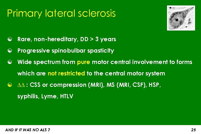 Primary lateral sclerosis ☯ Rare, non-hereditary, DD > 3 years ☯ Progressive spinobulbar spasticity