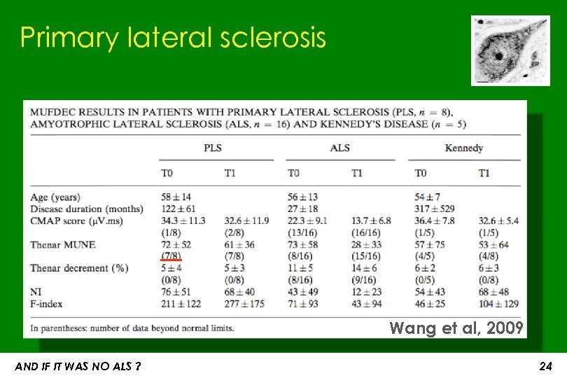 Primary lateral sclerosis Wang et al, 2009 AND IF IT WAS NO ALS ?