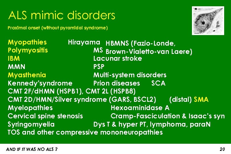 ALS mimic disorders Proximal onset (without pyramidal syndrome) Myopathies Hirayama HBMNS (Fazio-Londe, Polymyositis MS