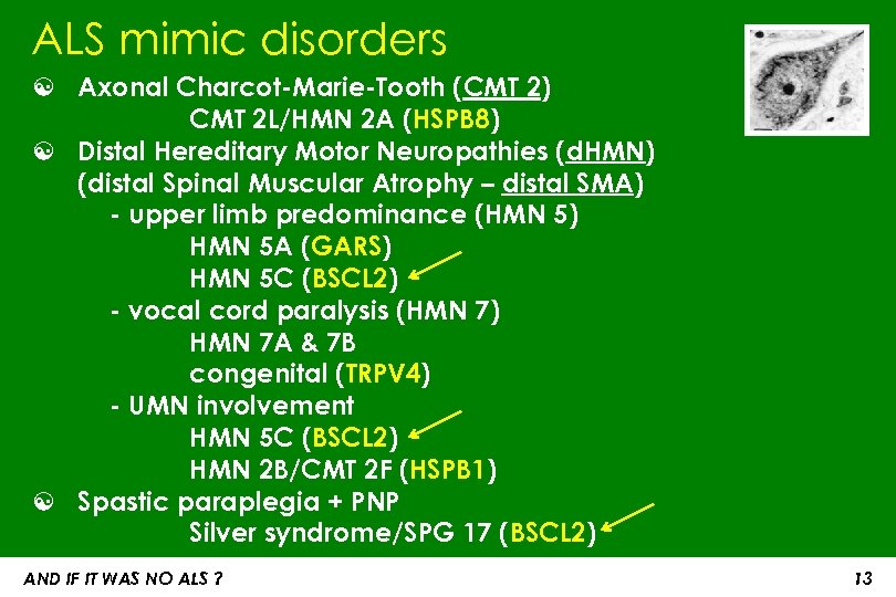 ALS mimic disorders ☯ Axonal Charcot-Marie-Tooth (CMT 2) CMT 2 L/HMN 2 A (HSPB