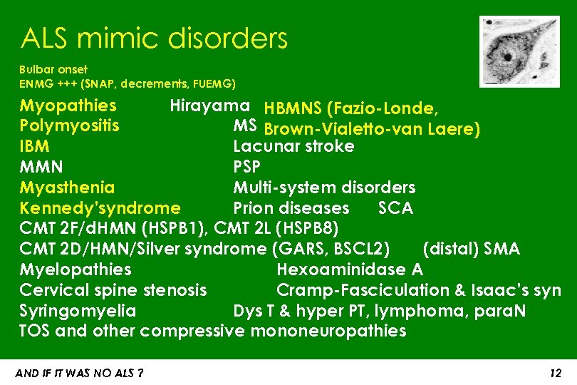 ALS mimic disorders Bulbar onset ENMG +++ (SNAP, decrements, FUEMG) Myopathies Hirayama HBMNS (Fazio-Londe,