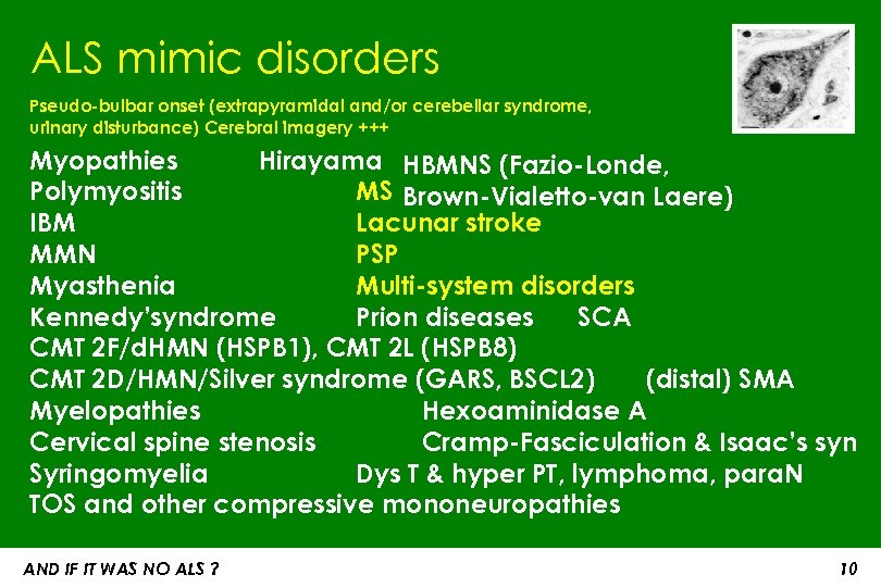 ALS mimic disorders Pseudo-bulbar onset (extrapyramidal and/or cerebellar syndrome, urinary disturbance) Cerebral imagery +++