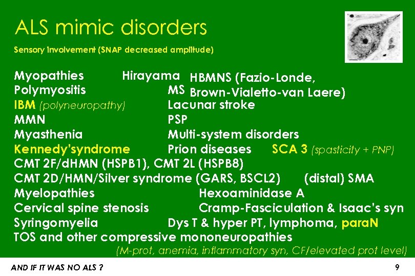 ALS mimic disorders Sensory involvement (SNAP decreased amplitude) Myopathies Hirayama HBMNS (Fazio-Londe, Polymyositis MS