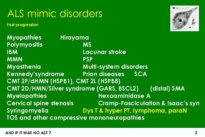 ALS mimic disorders Fast progression Myopathies Hirayama Polymyositis MS IBM Lacunar stroke MMN PSP