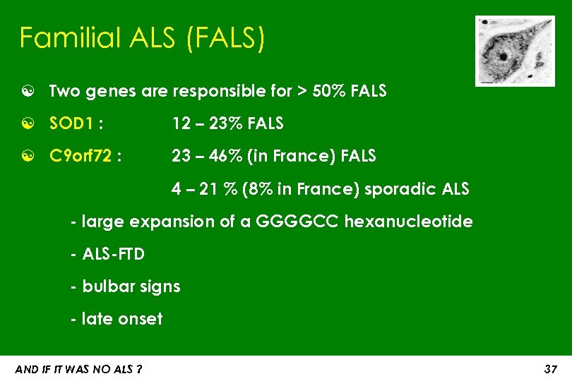 Familial ALS (FALS) ☯ Two genes are responsible for > 50% FALS ☯ SOD