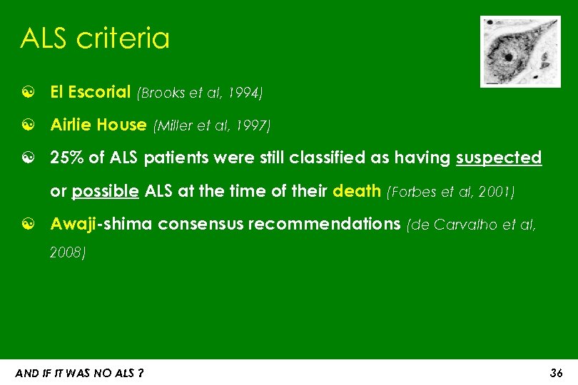 ALS criteria ☯ El Escorial (Brooks et al, 1994) ☯ Airlie House (Miller et