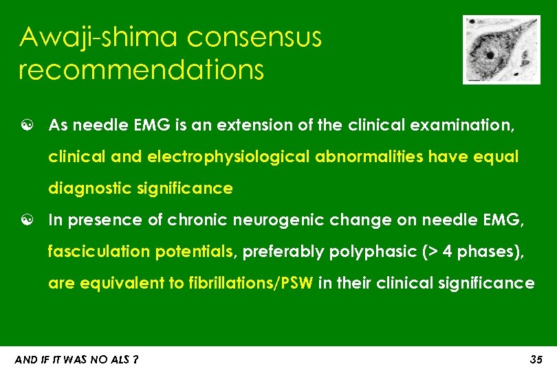 Awaji-shima consensus recommendations ☯ As needle EMG is an extension of the clinical examination,