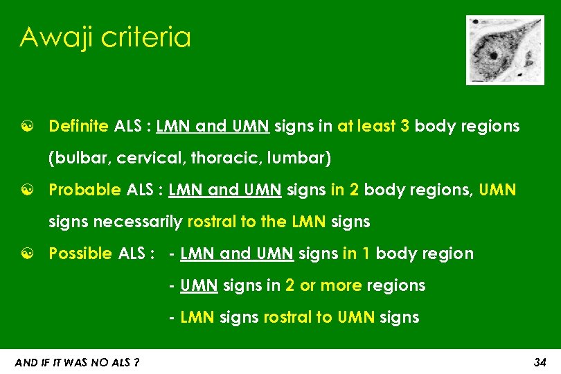 Awaji criteria ☯ Definite ALS : LMN and UMN signs in at least 3