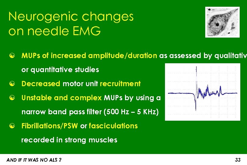 Neurogenic changes on needle EMG ☯ MUPs of increased amplitude/duration as assessed by qualitativ