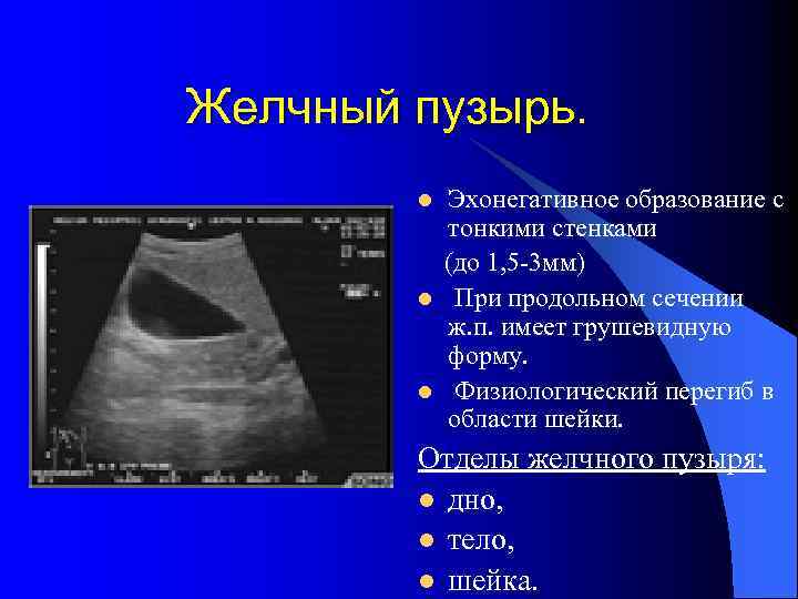 Желчный пузырь. l l l Эхонегативное образование с тонкими стенками (до 1, 5 -3