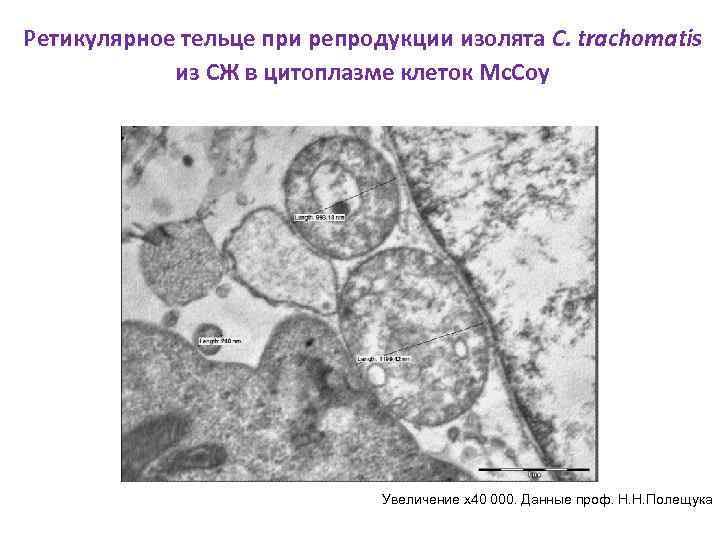Ретикулярное тельце при репродукции изолята C. trachomatis из СЖ в цитоплазме клеток Мс. Соу