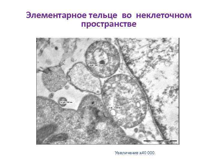Элементарное тельце во неклеточном пространстве Увеличение х40 000. 
