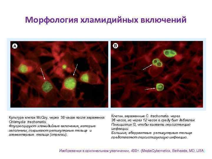 Морфология хламидийных включений Культура клеток Mc. Coy, через 36 часов после заражения Chlamydia trachomatis.