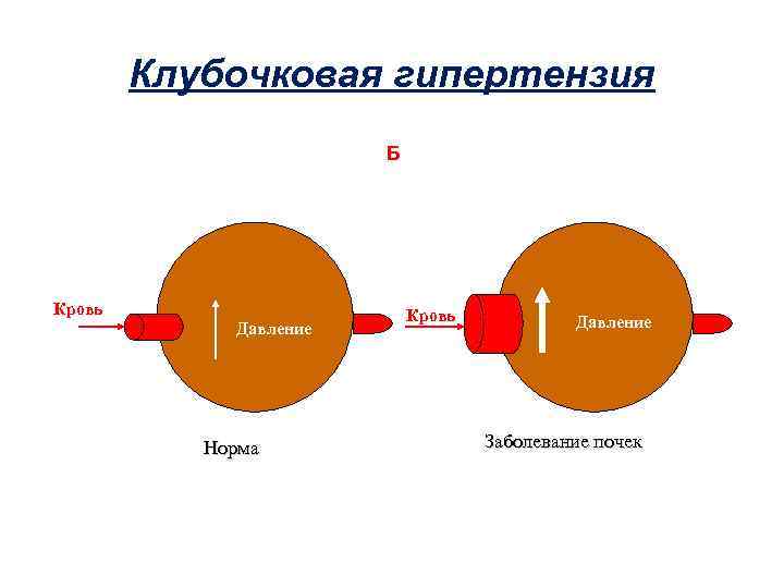 Клубочковая гипертензия Б Кровь Давление Норма Кровь Давление Заболевание почек 