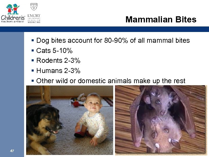 Mammalian Bites § Dog bites account for 80 -90% of all mammal bites §