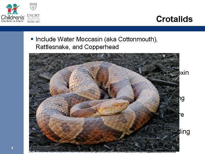 Crotalids § Include Water Moccasin (aka Cottonmouth), Rattlesnake, and Copperhead § Venom is a