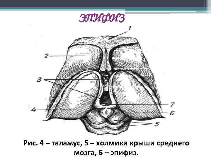 Эпифиз на рисунке