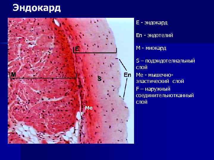 Срез стенки сердца рисунок