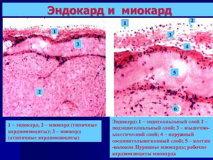 Эндокард и миокард 2 1 1 3 3 4 5 2 6 1 –