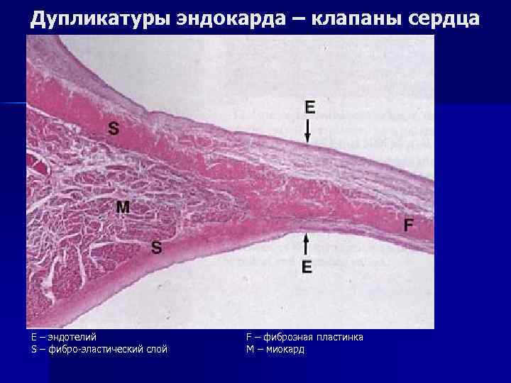 Дупликатуры эндокарда – клапаны сердца E – эндотелий S – фибро-эластический слой F –