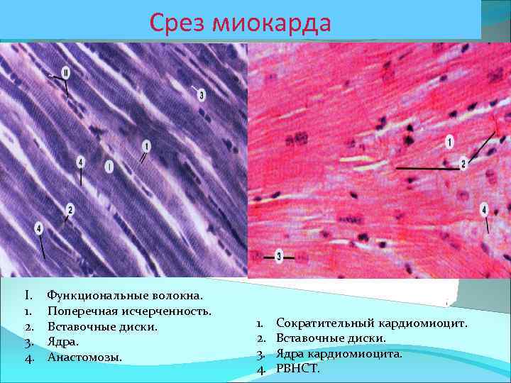 Миокард гистология рисунок