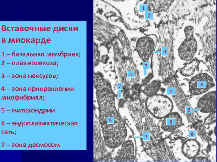 1 2 Вставочные диски в миокарде 3 1 – базальная мембрана; 2 – плазмолемма;