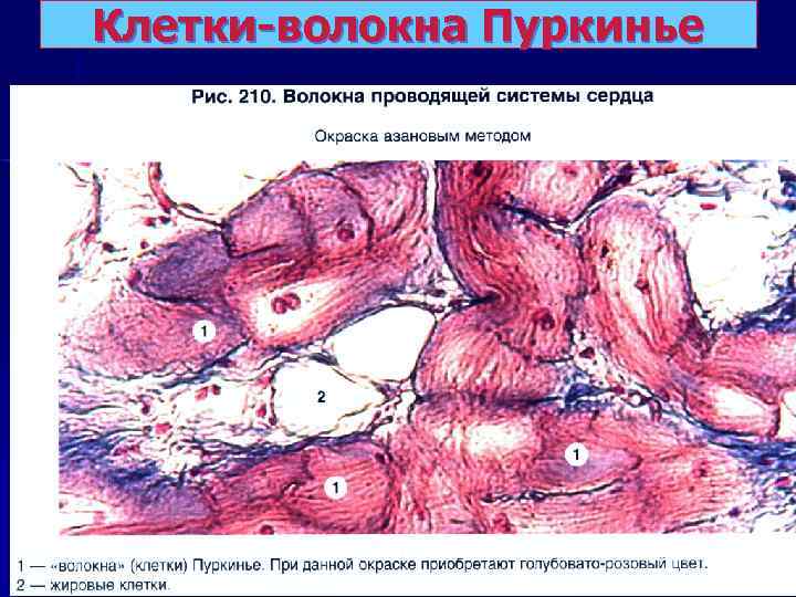 Клетки-волокна Пуркинье 