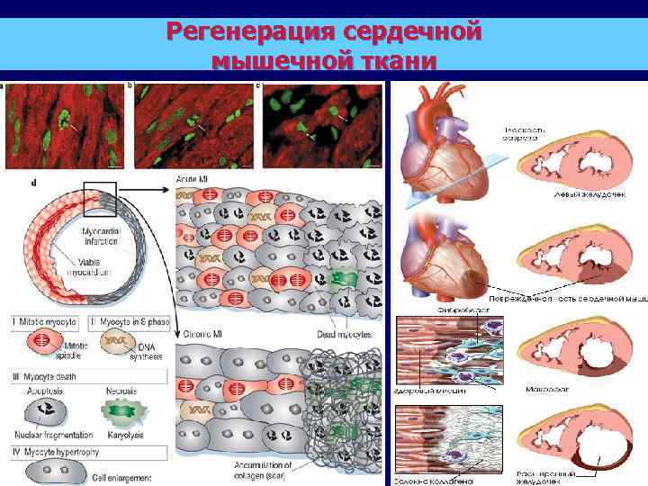 Регенерация сердечной мышечной ткани 