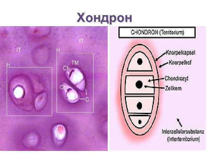 Хондрон 