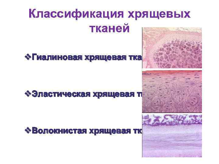 Какая ткань изображена на картинке хрящевые ткани