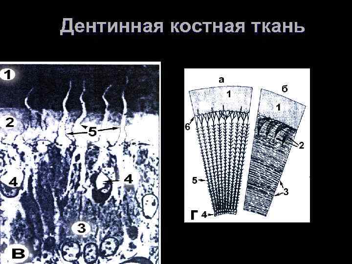 Дентинная костная ткань 