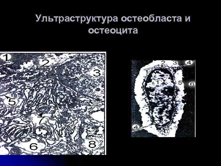 Ультраструктура остеобласта и остеоцита 