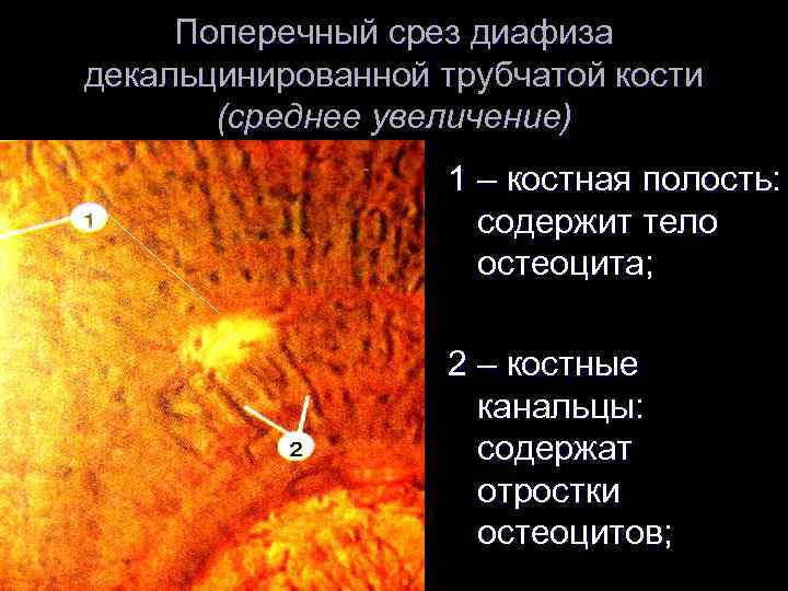 Поперечный срез диафиза декальцинированной трубчатой кости (среднее увеличение) 1 – костная полость: содержит тело