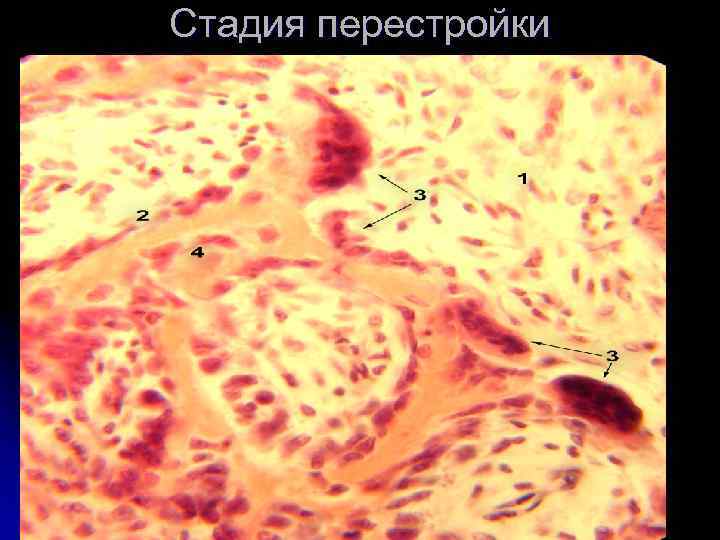 Стадия перестройки 