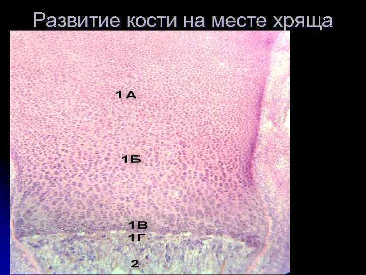 Развитие кости на месте хряща гистология рисунок