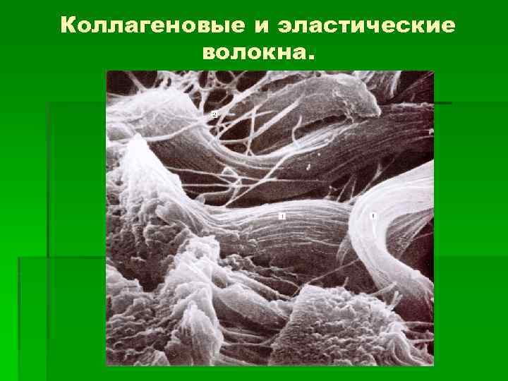 Коллагеновые и эластические волокна. 