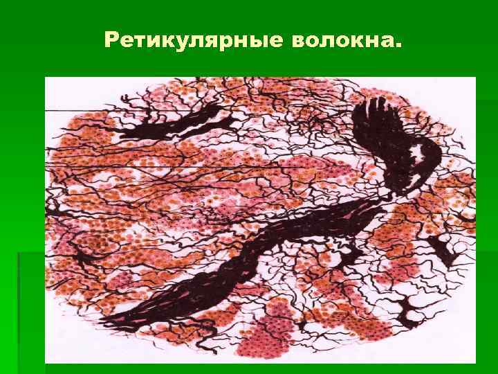 Ретикулярные волокна. 