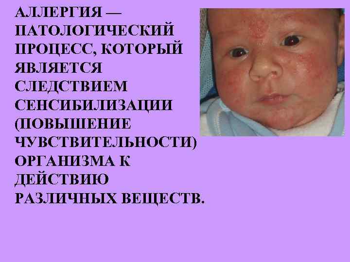 АЛЛЕРГИЯ — ПАТОЛОГИЧЕСКИЙ ПРОЦЕСС, КОТОРЫЙ ЯВЛЯЕТСЯ СЛЕДСТВИЕМ СЕНСИБИЛИЗАЦИИ (ПОВЫШЕНИЕ ЧУВСТВИТЕЛЬНОСТИ) ОРГАНИЗМА К ДЕЙСТВИЮ РАЗЛИЧНЫХ
