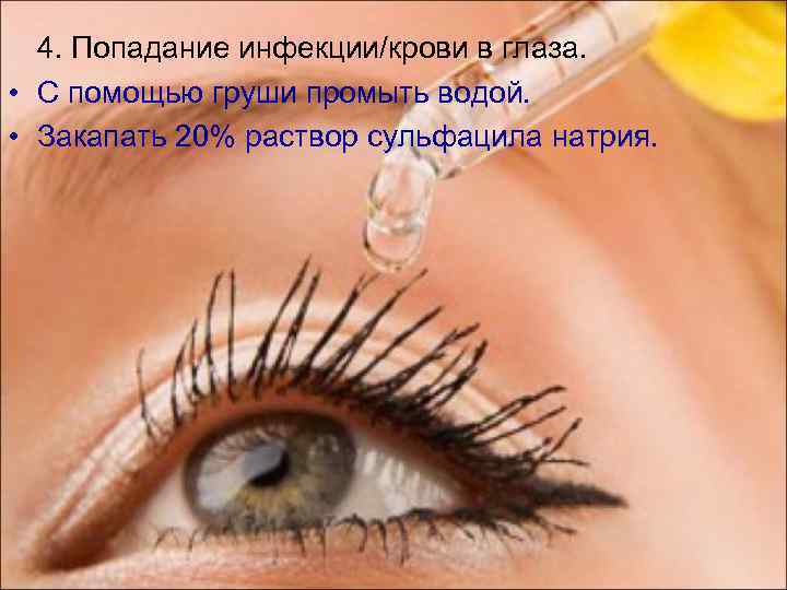 4. Попадание инфекции/крови в глаза. • С помощью груши промыть водой. • Закапать 20%