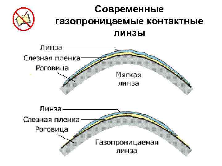 Современные газопроницаемые контактные линзы 