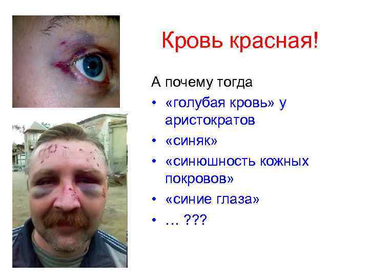 Кровь красная! А почему тогда • «голубая кровь» у аристократов • «синяк» • «синюшность