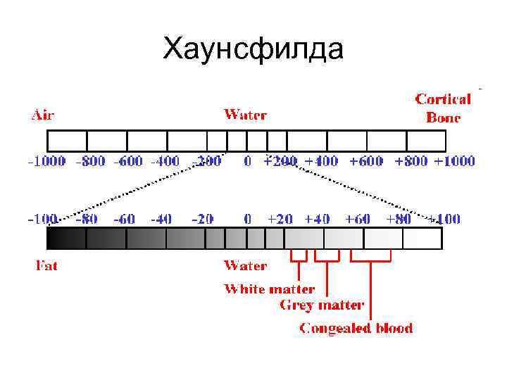 Шкала хаунсфилда презентация