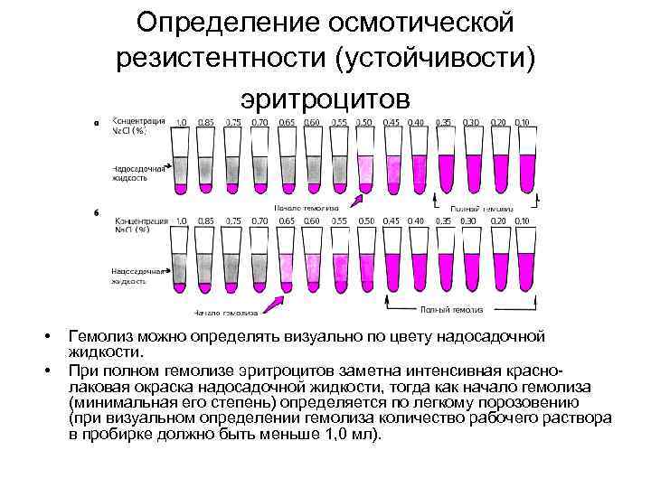 Гемолиз образца крови что это