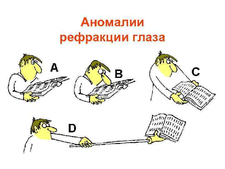 Аномалии рефракции глаза 